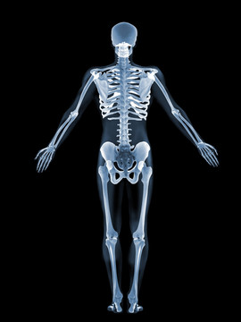 骨骼X光影像