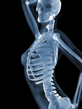 骨骼X光影像