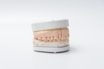 牙模型