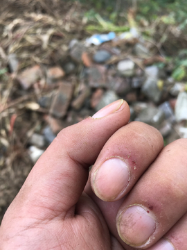 手指毛刺