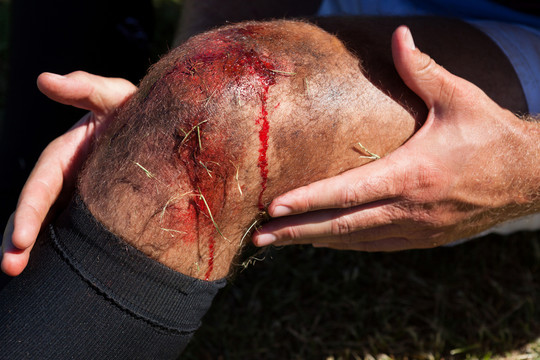 橄榄球运动员膝盖受伤的特写镜头