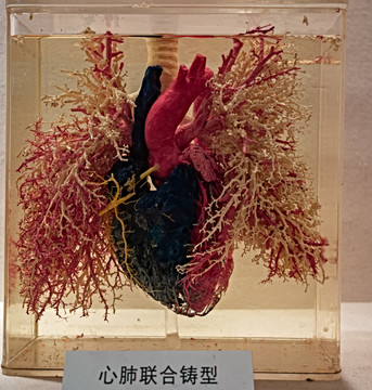 心肺联合铸型