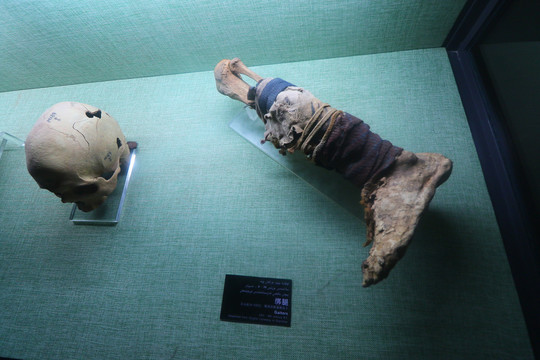新疆吐鲁番博物馆干尸脚头骨