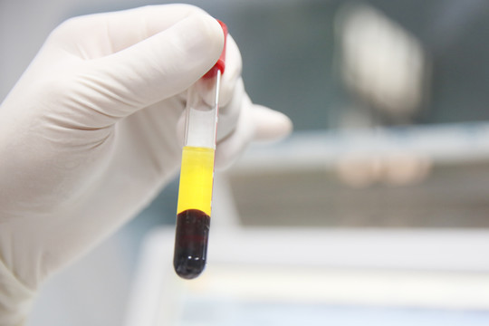 化验室检验科血液生化分析