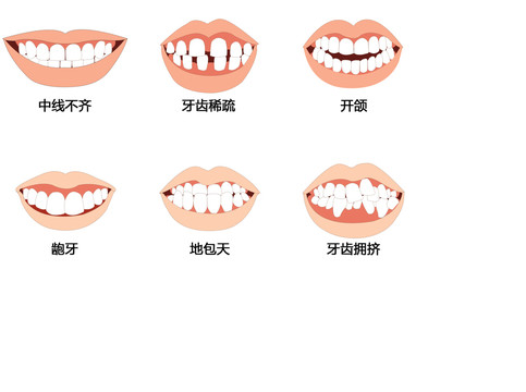 口腔矫正