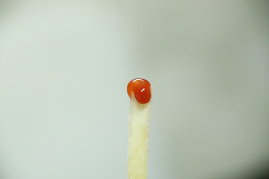 薯条