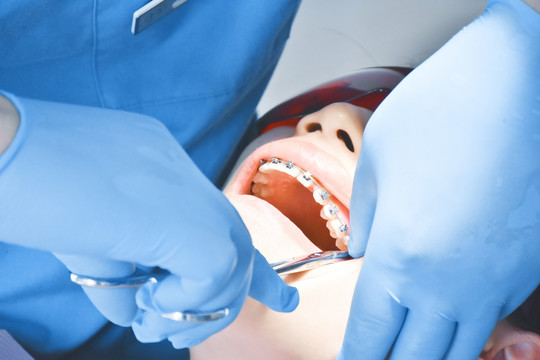 牙科矫正治疗手术