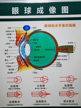 眼科眼球成像图