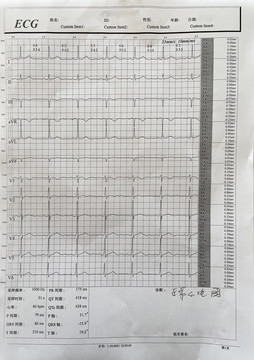 心电图报告单