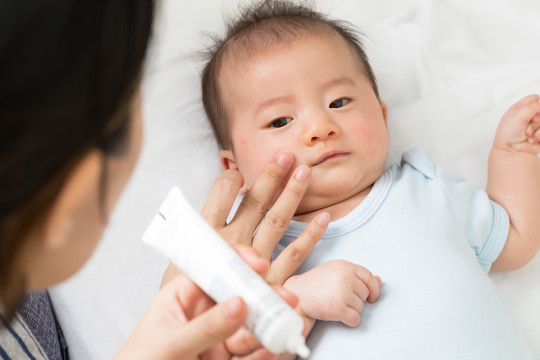 母亲正在给男婴使用面霜，这有助于保持皮肤面部水分、护肤和保湿面霜的概念