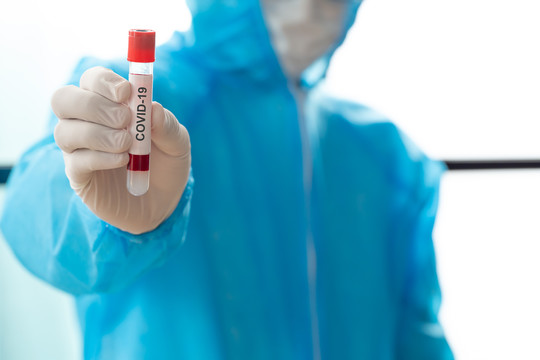 佩戴PPE 2019冠状病毒疾病的研究人员，为疫苗研究预防或治疗新冠状病毒SARS COV-2，医师