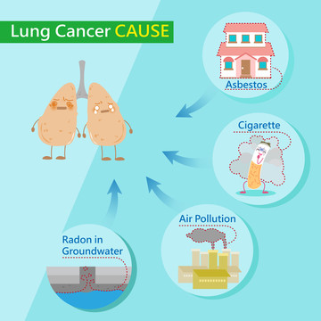 肺癌成因来源卡通插图