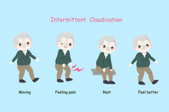 银发老人间歇性跛行示意插画