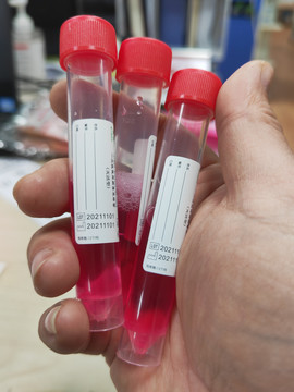 核酸检测病毒培养液
