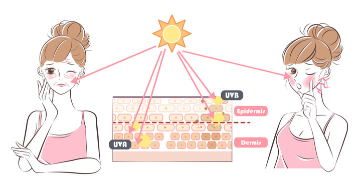 少女肌肤晒伤细纹产生插图