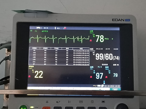 多功能心电监护仪