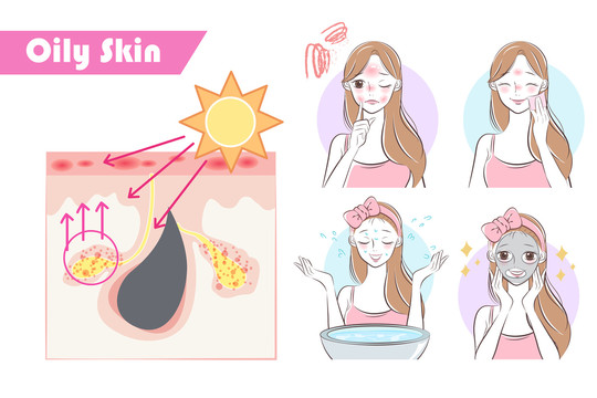 阳光对油性肌肤造成的问题及解决方式插图