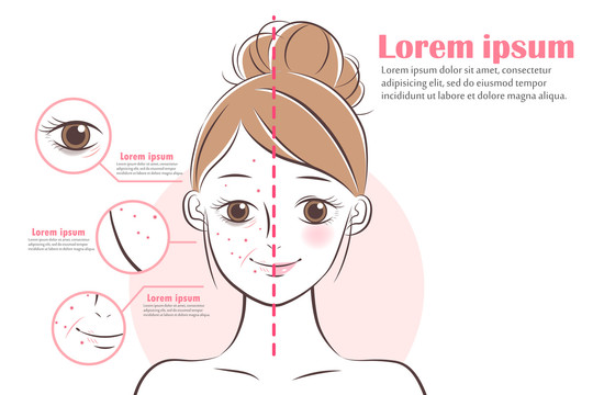 手绘风女人 脸上肌肤问题概念插图