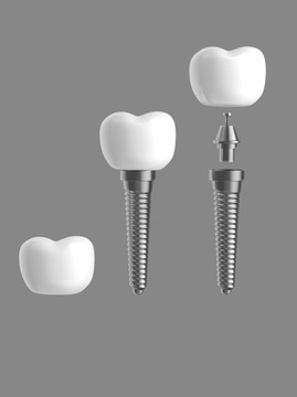 3D种植牙分解爱牙护牙
