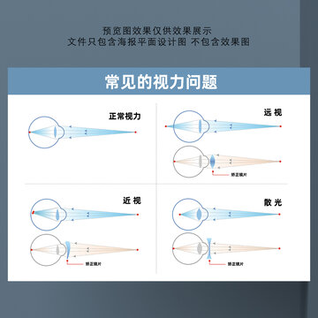 矫正视力原理示意图