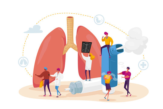 医疗团队检查哮喘病患的巨大肺部平面插图