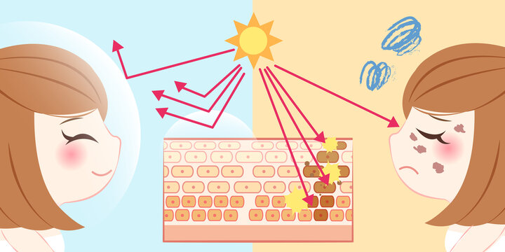 女性做好防晒避免晒斑对照插图