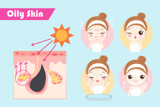 女性肌肤晒伤油脂分泌 洗脸护肤插图