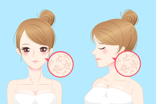 干性肌肤 脸部有细纹的女性插图