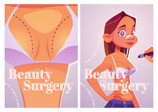 女孩整形手术术前准备 插画海报