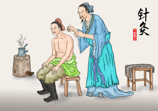 针灸插画