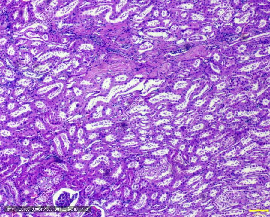 肾脏组织切片,显微摄影,人类器