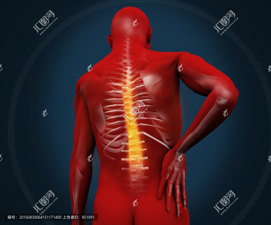 腰部疼痛的人体图像