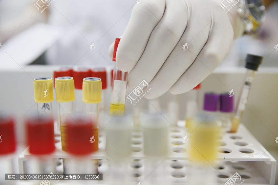 化验室检验科血液生化分析