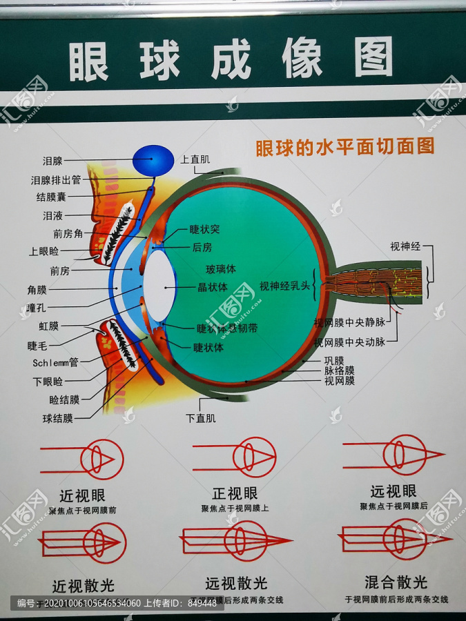 眼科眼球成像图