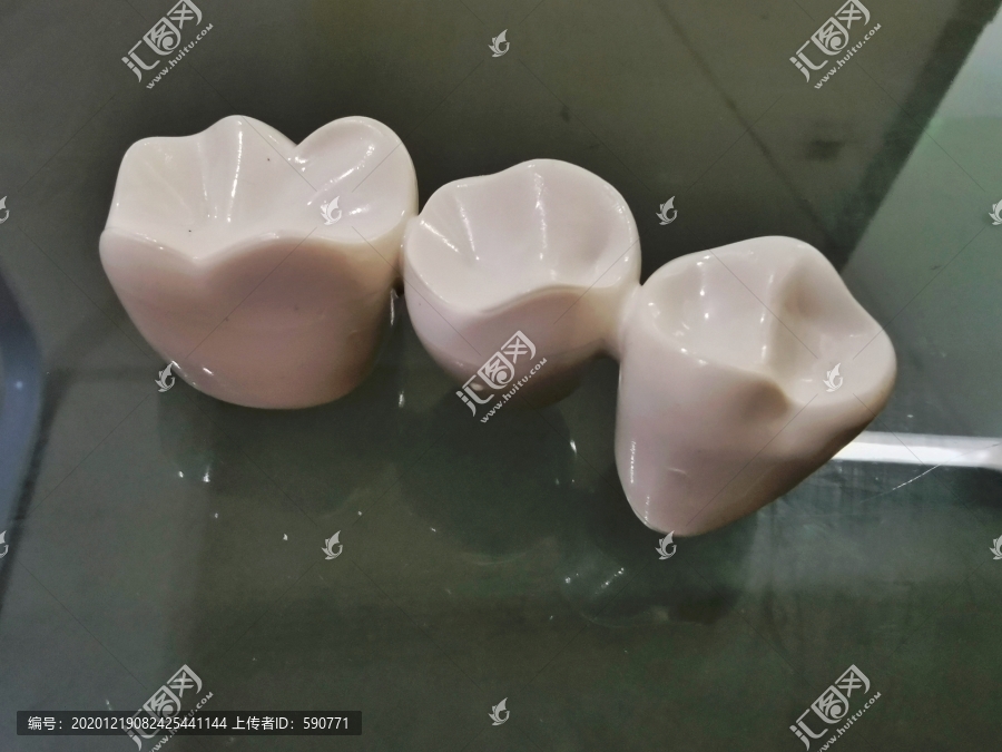 牙齿模型
