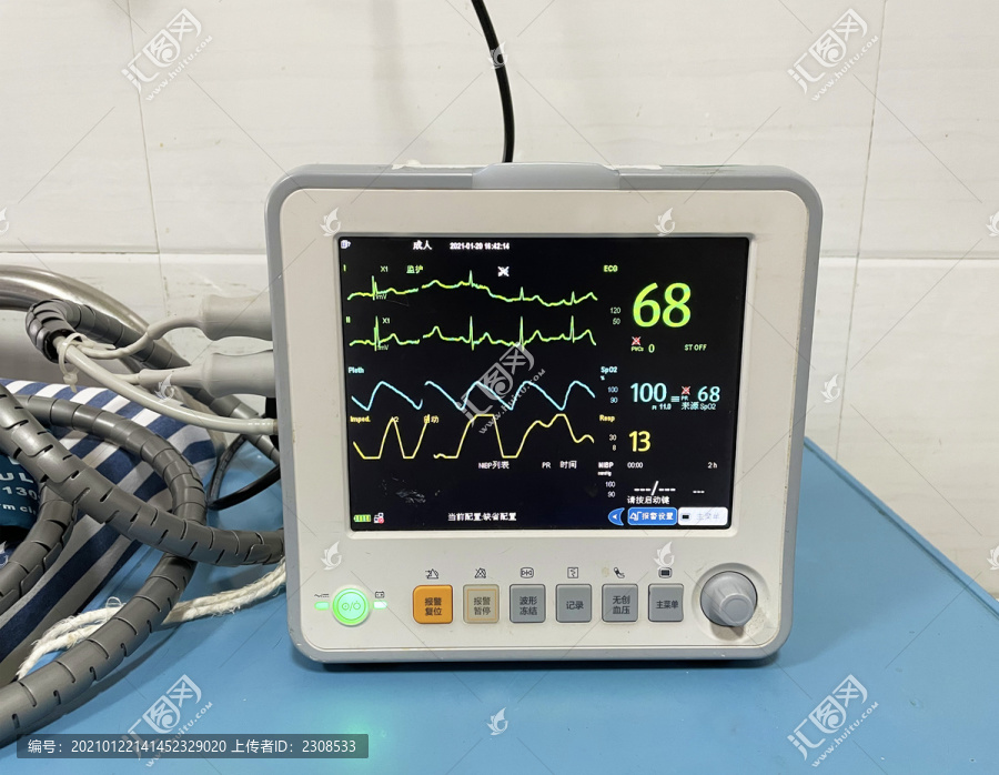多功能心电监护仪