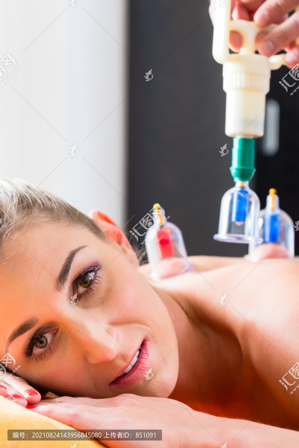 妇女在替代医疗拔罐疗法与杯子被应用在她的背部