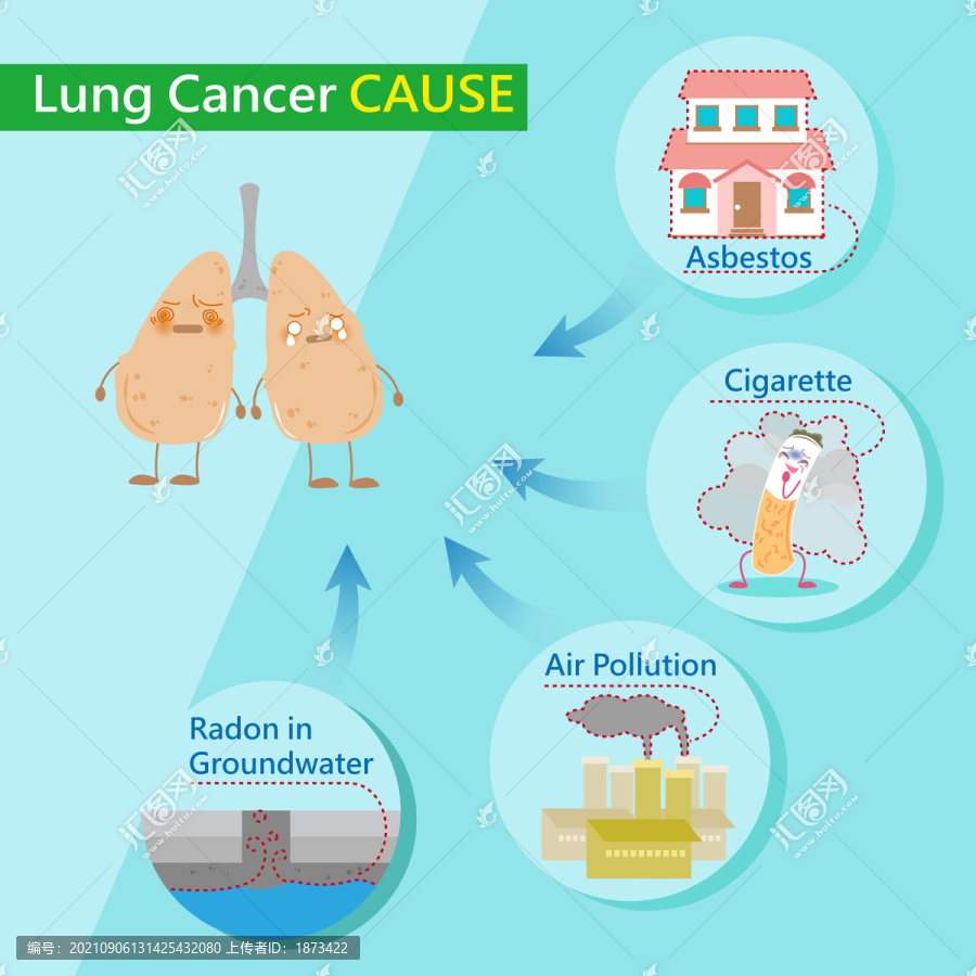 肺癌成因来源卡通插图