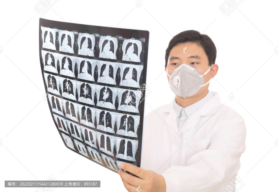 大夫在仔细查看肺部X光片
