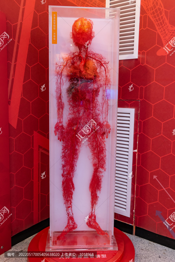 人体血管模型