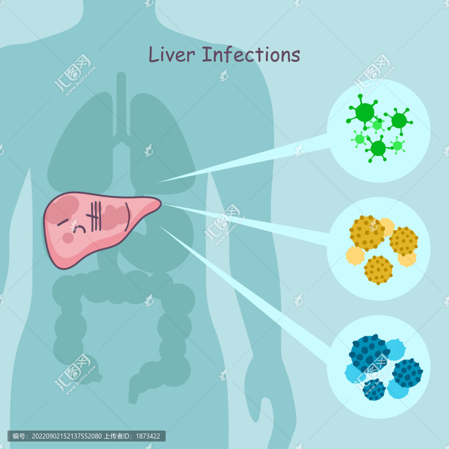 卡通风肝脏被细菌感染插图