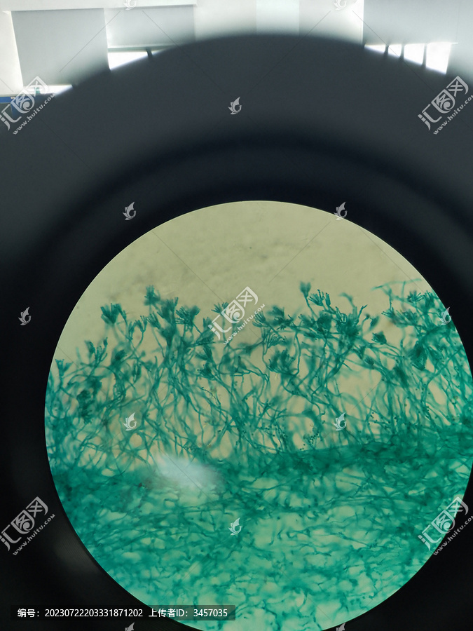 显微镜下的霉菌芽孢